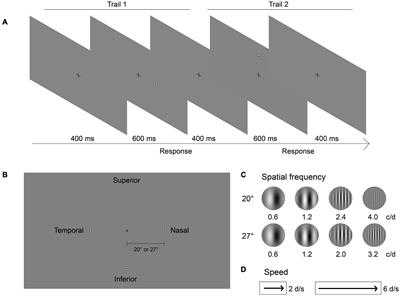 Is Peripheral Motion Detection Affected by Myopia?